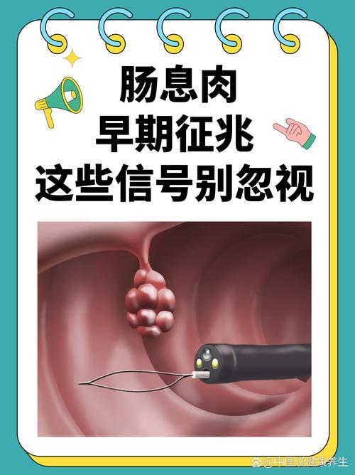 回顾：山东男子查出肠息肉，查明原因，医生说：忽略了一项指标